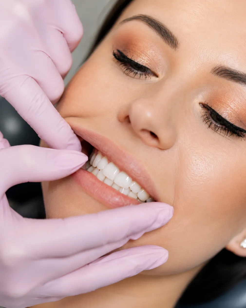 Advantages of Invisalign