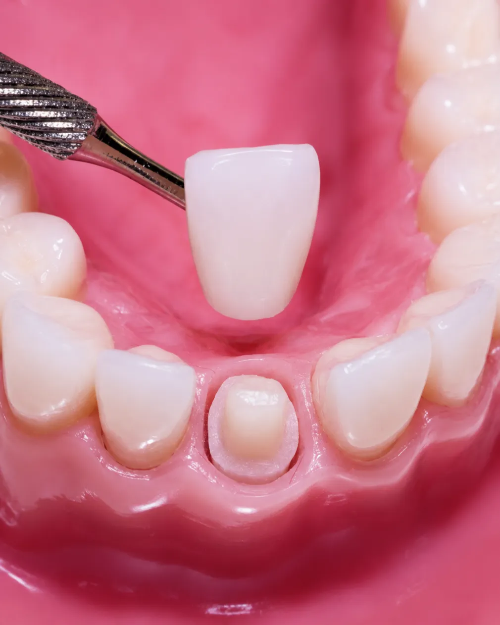 Canadian Dental Care Plan (CDCP)