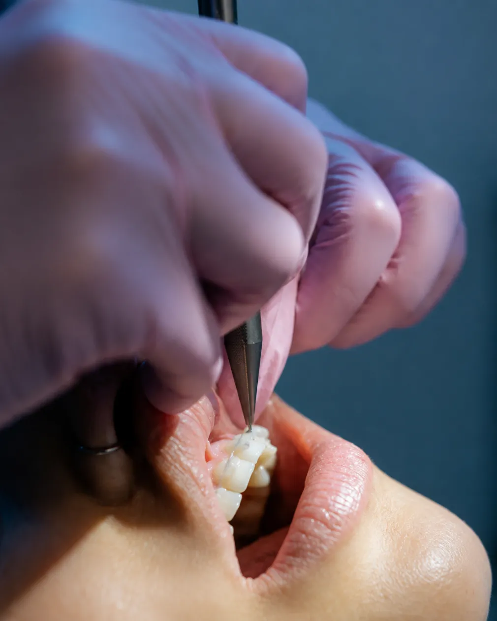 Orthodontics