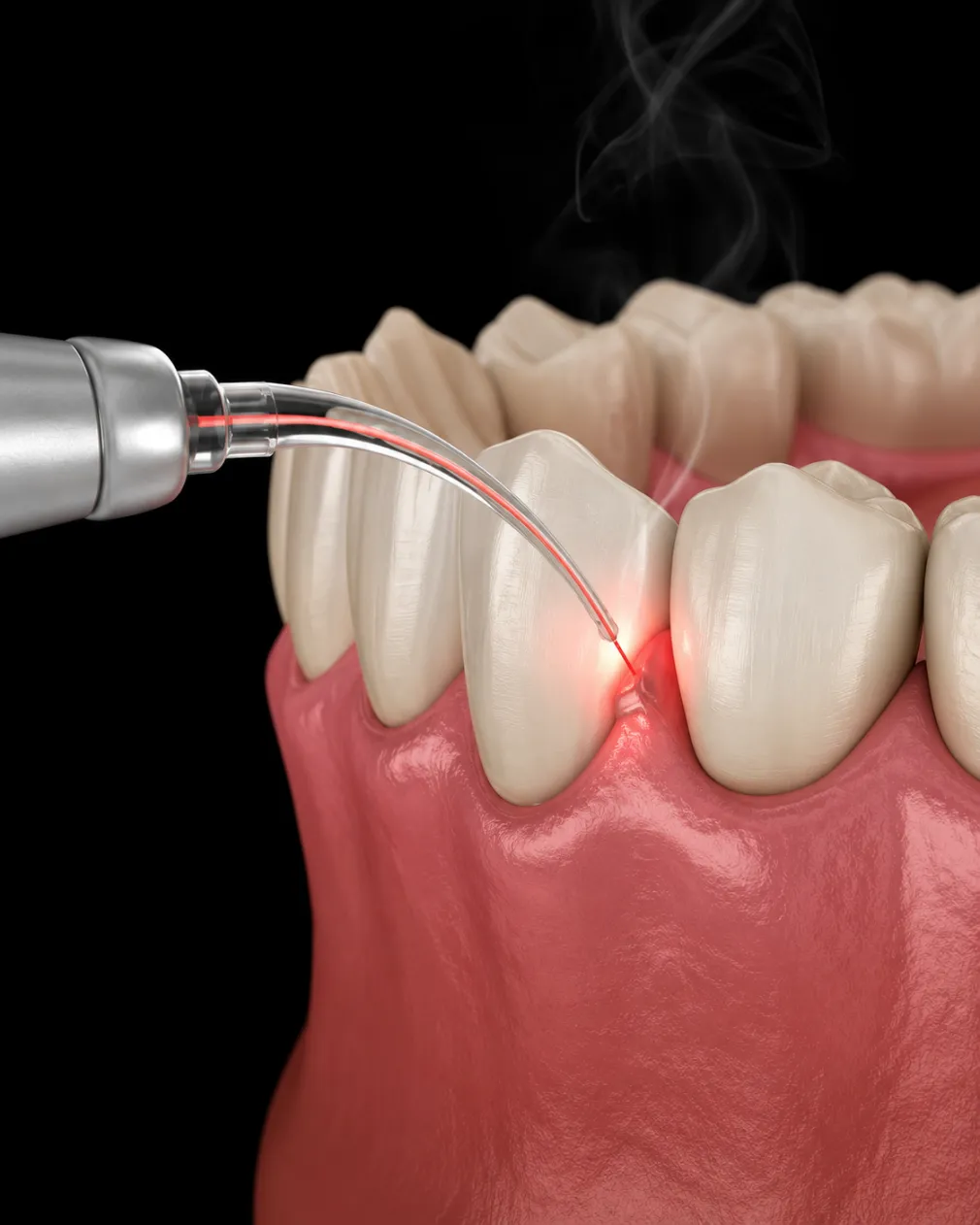 Gum Surgery Services