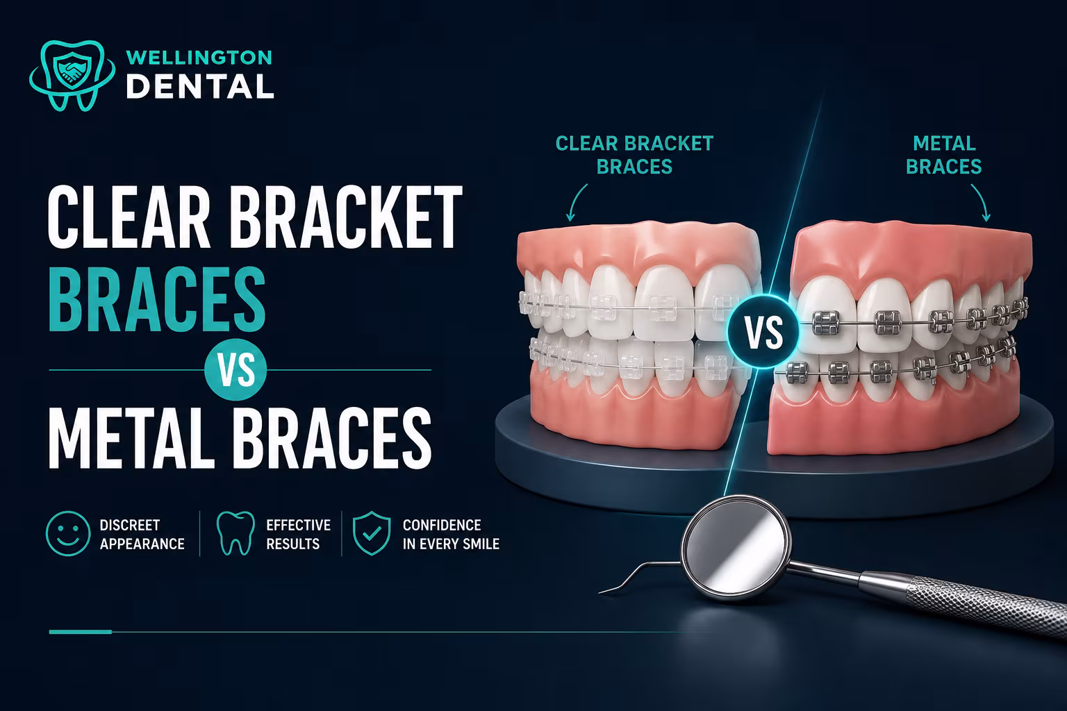 Clear Bracket Braces vs. Metal Braces: Which is Right for You?