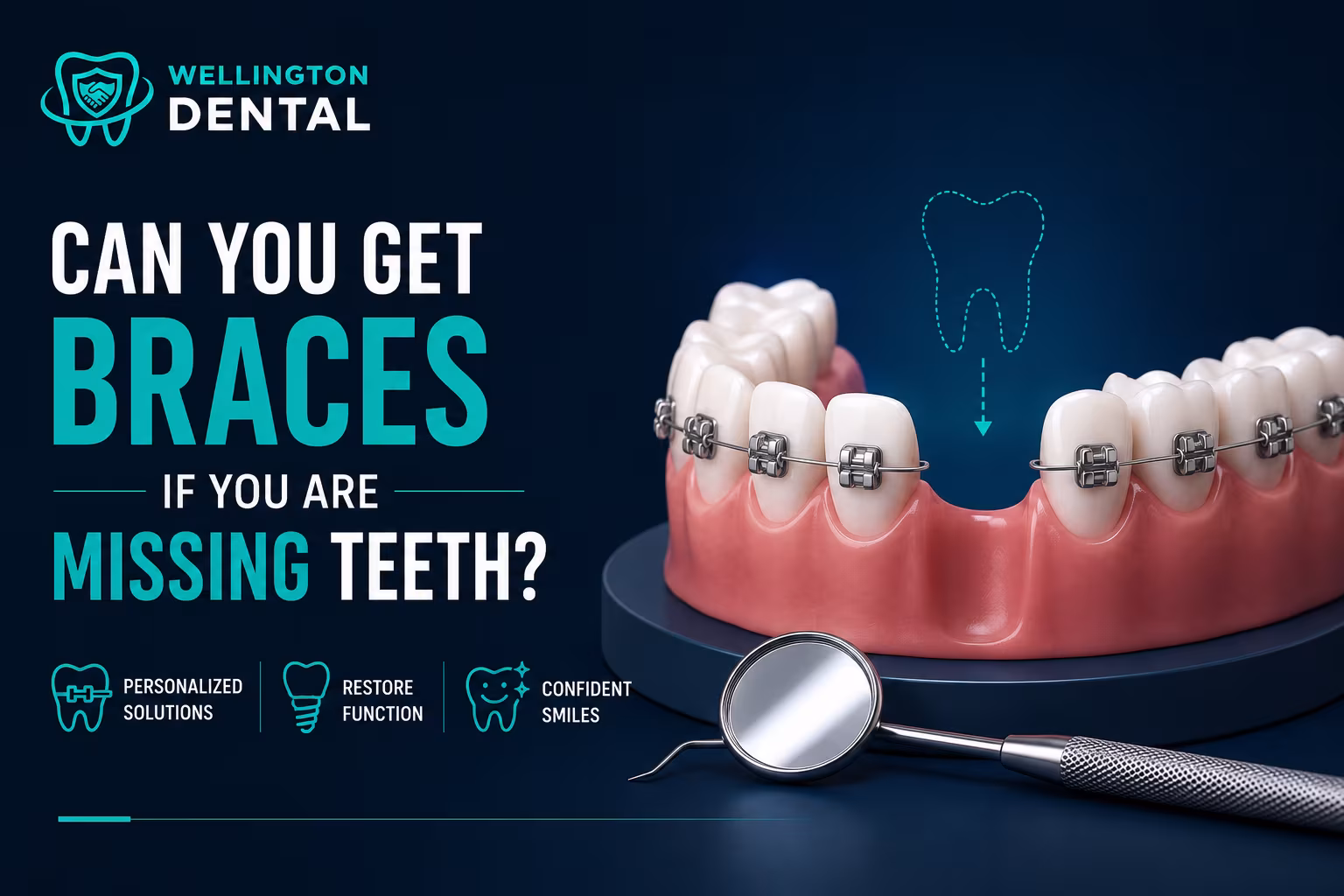 Can You Get Braces If You Are Missing Teeth?