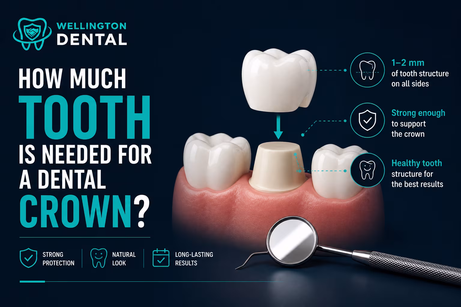 How Much Natural Tooth is Needed for a Dental Crown?