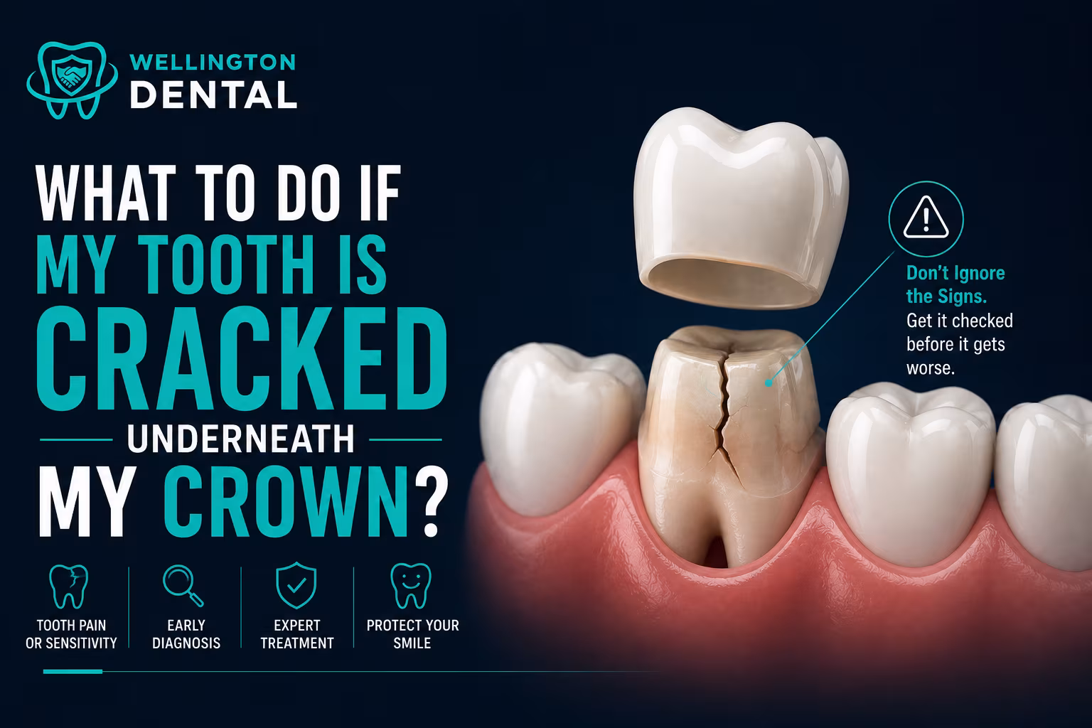 What to Do If Your Tooth is Cracked Underneath a Crown