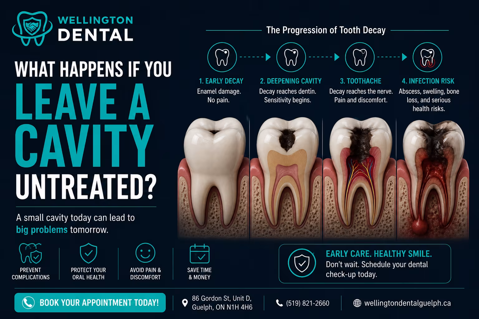 What Happens If You Leave a Cavity Untreated?