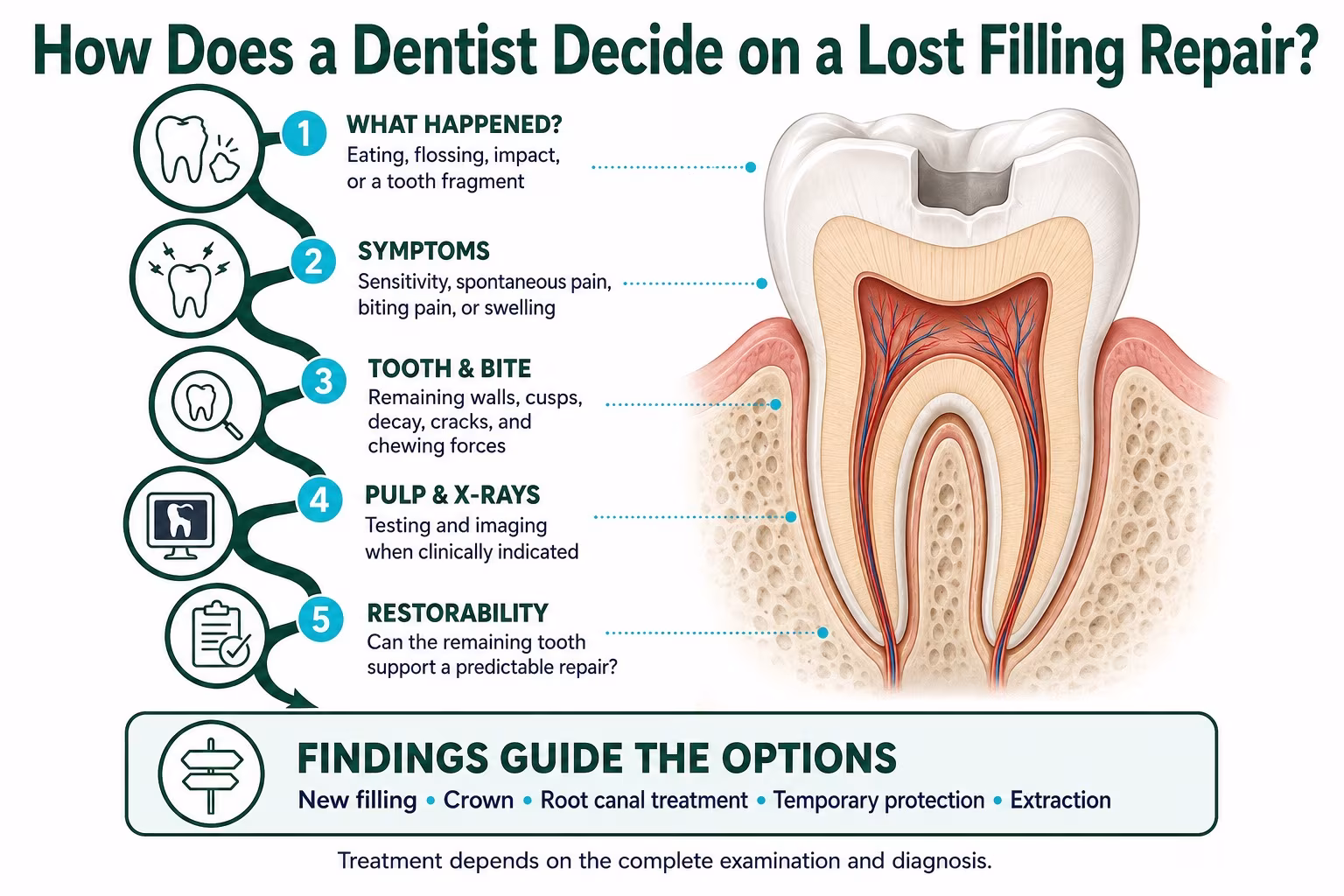 Infographic explaining how dentists assess symptoms, tooth structure, X-rays, and restorability to choose a lost filling repair