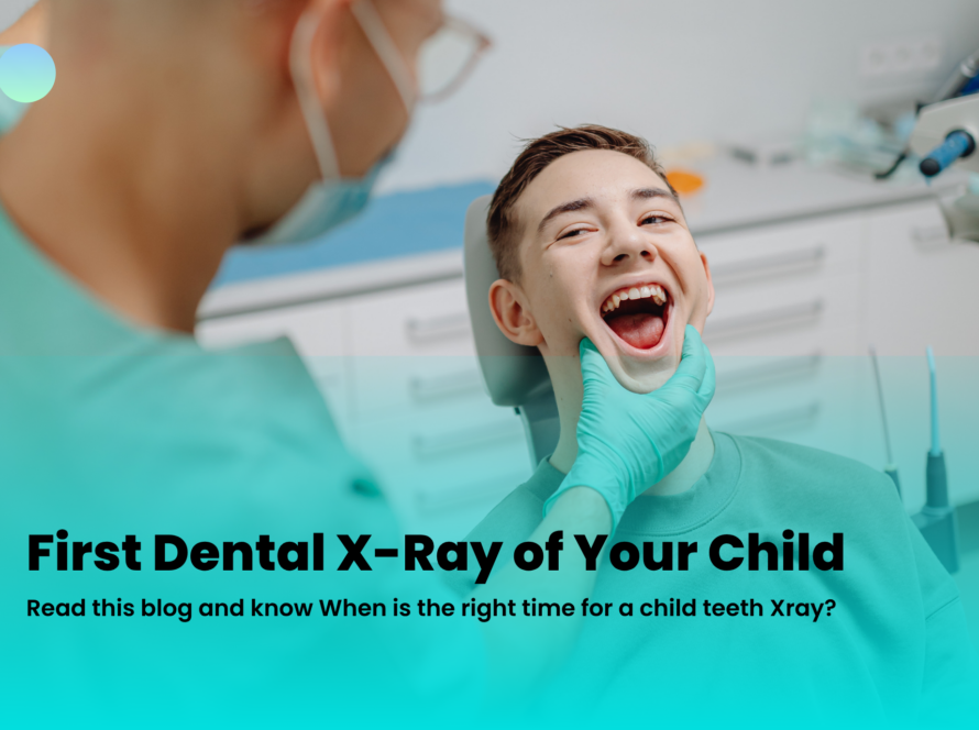 Dental X-Ray