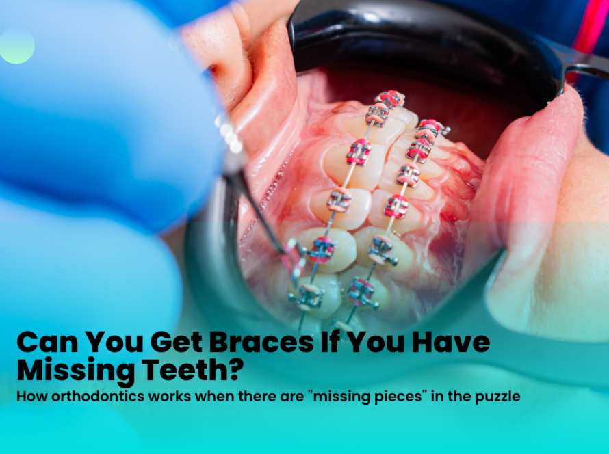 Braces