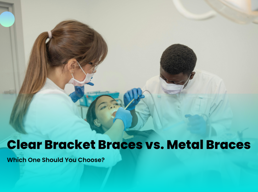 Metal Braces